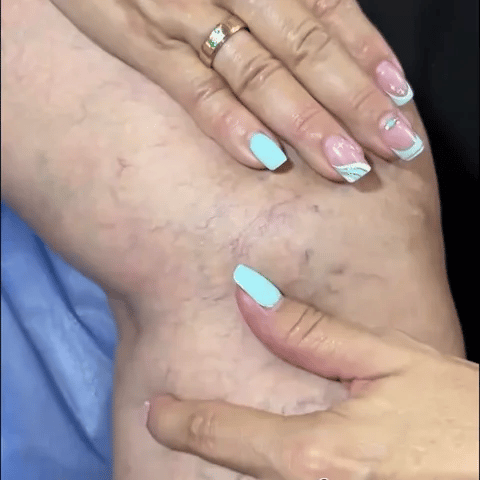 Paga 1 Lleva 2  Medias de Compresión con Cierre