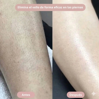 Rasuradora Depiladora 2 en 1: Piel suave y sin irritación en minutos.