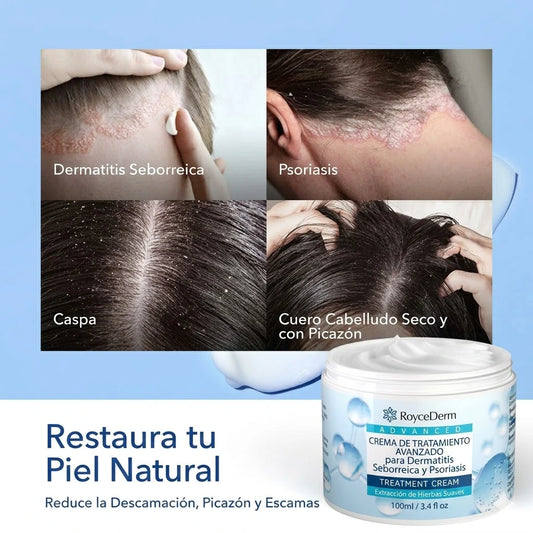 Fórmula en Crema | Para el  Alivio Real de la  Psoriasis y Dermatitis Seborreica.