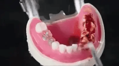 Irrigador Dental Portátil